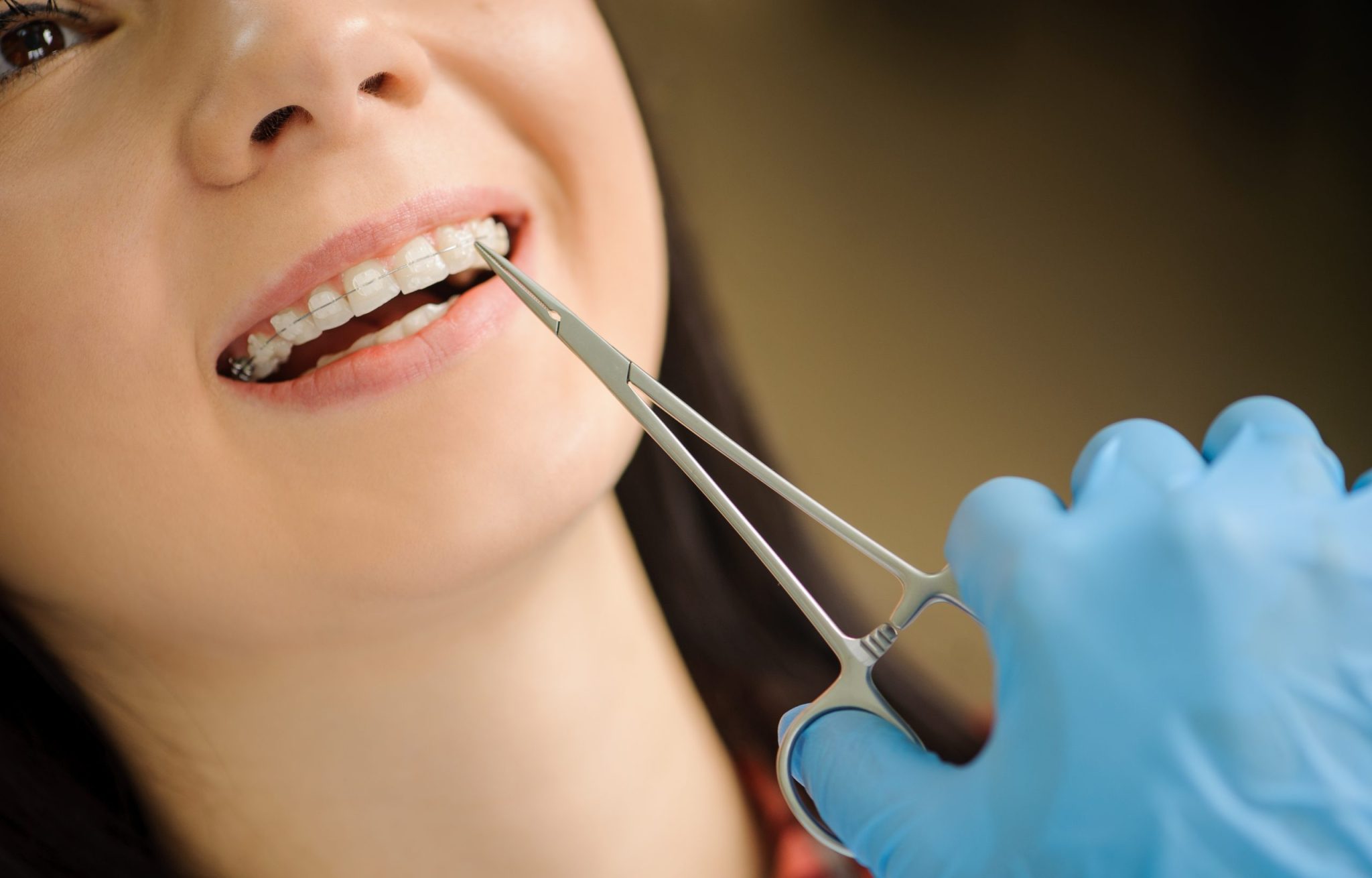 Orthodontics Eastbourne Gentle Dental