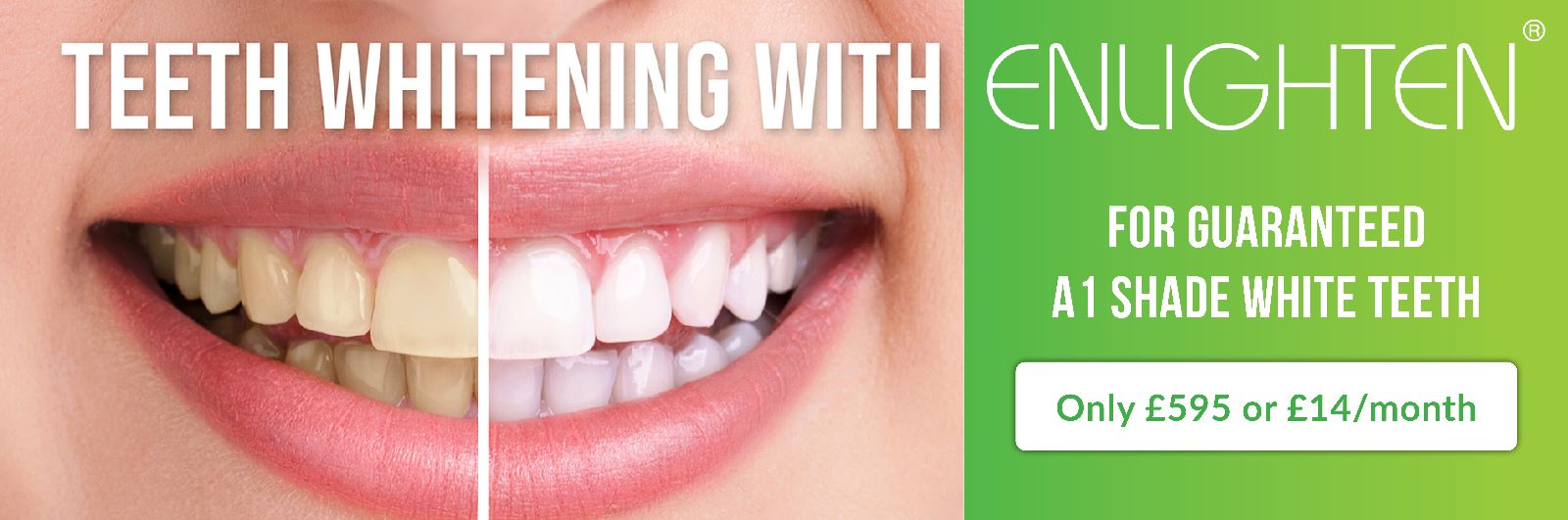 Eastbourne Gentle Dental Independent Private Dental Practice